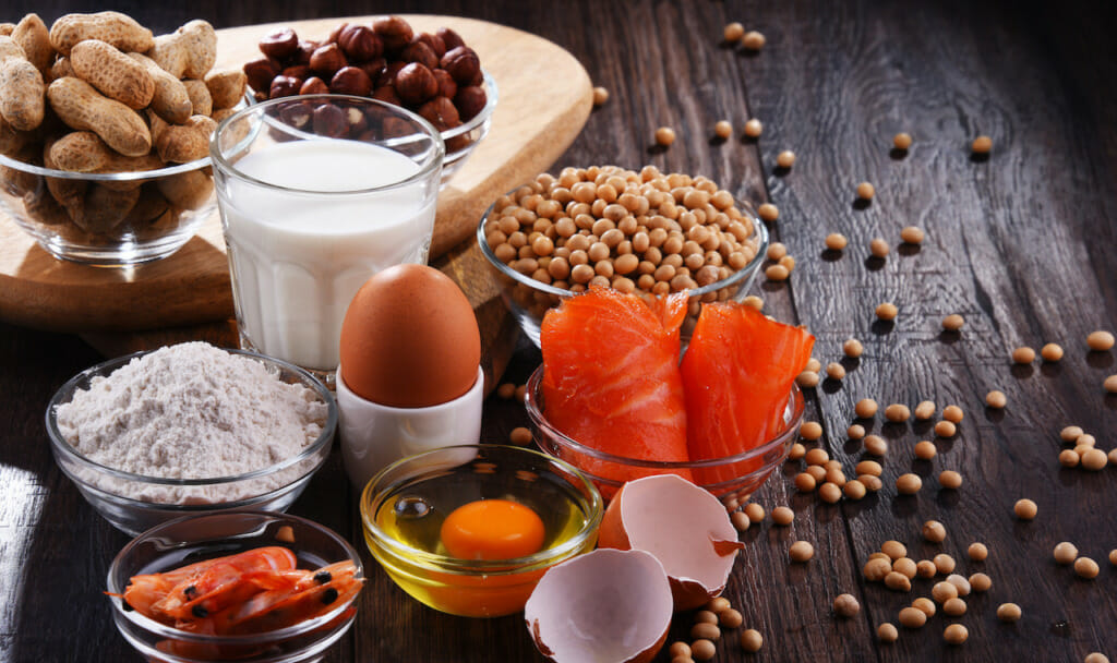 The top 9 food allergens include milk, eggs, peanuts, tree nuts, fish, shellfish, wheat, soy, and sesame.